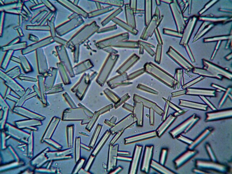 Close-up view of crystalline structures under a microscope, showcasing intricate details.